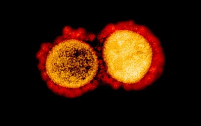 VAKCINA BIZNISZ – sertésinfluenza (H1N1)